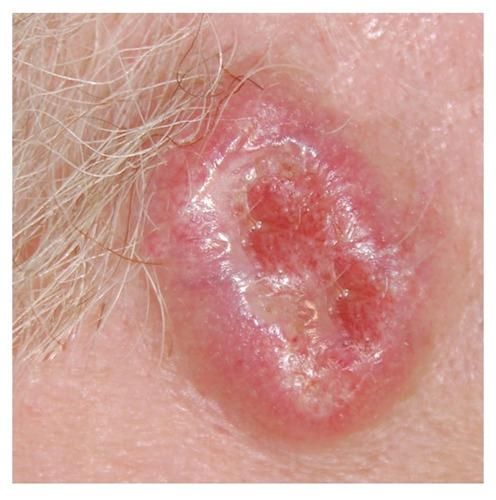 BCC warning signs — example 2
